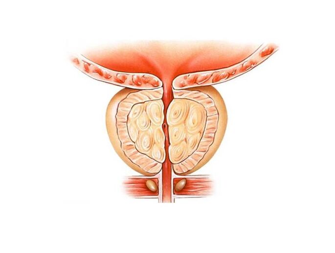 Entzündung vun der Prostata